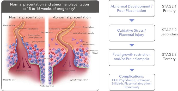 Placentation illustration